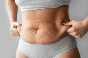 Cómo eliminar la piel sobrante en el abdomen después del embarazo